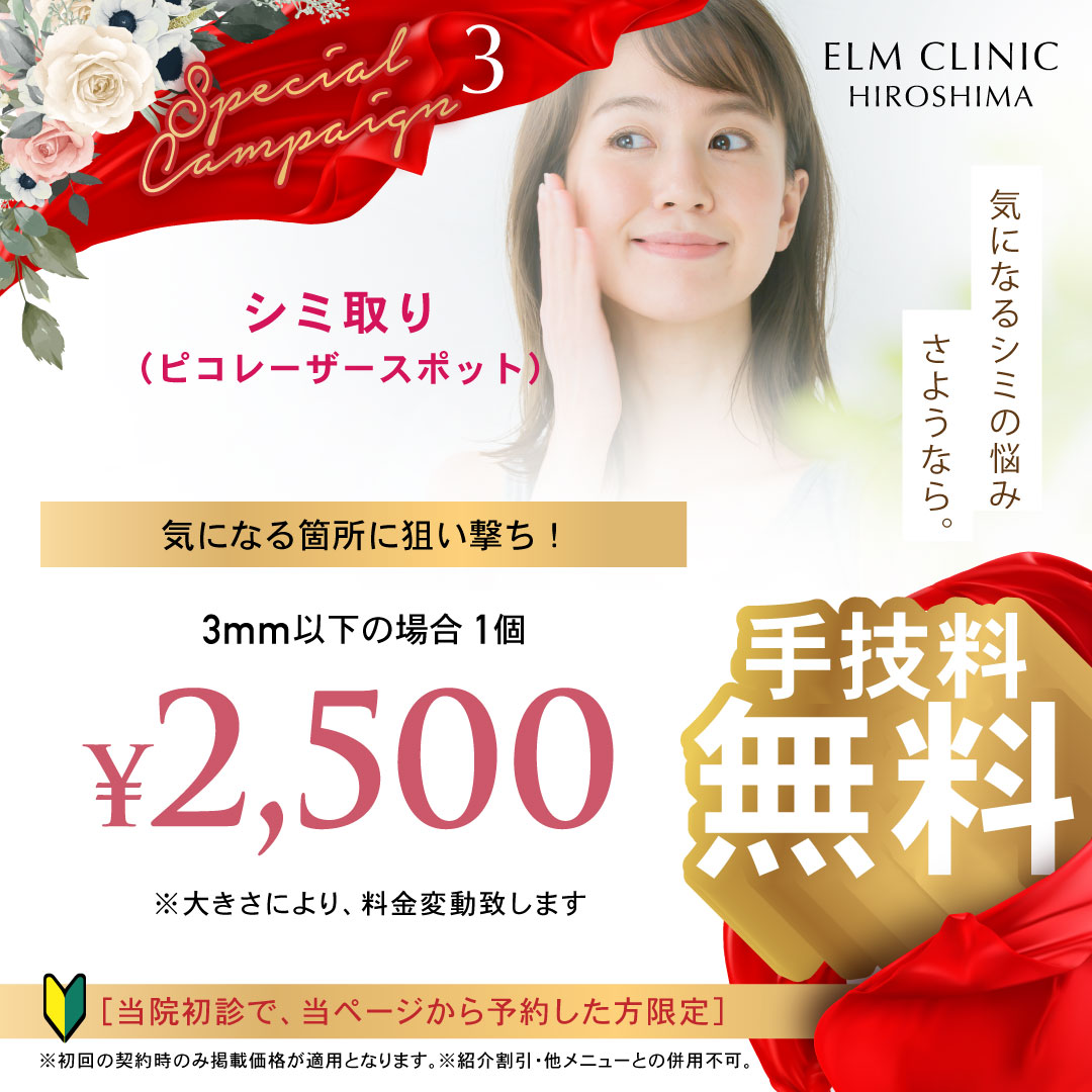 キャンペーン 3