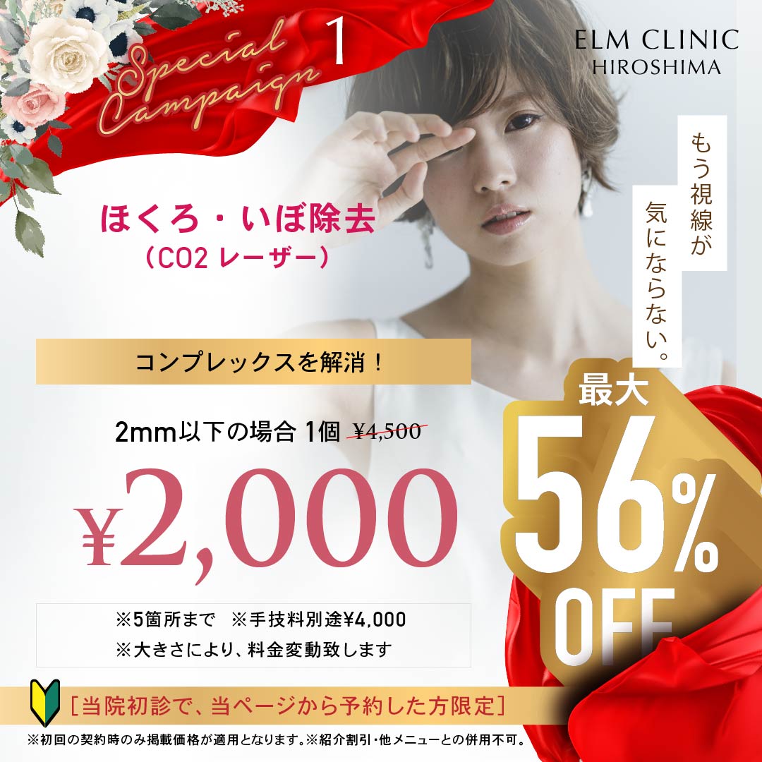 キャンペーン 1